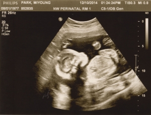 ultrasound 2014-12-10 11.jpg